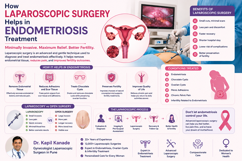 How Laparoscopic Surgery Helps in Endometriosis Treatment